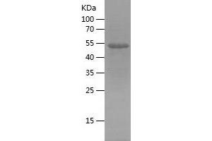 Western Blotting (WB) image for Reticulon 3 (RTN3) (AA 128-358) protein (His-IF2DI Tag) (ABIN7124837) (Reticulon 3 Protein (RTN3) (AA 128-358) (His-IF2DI Tag))