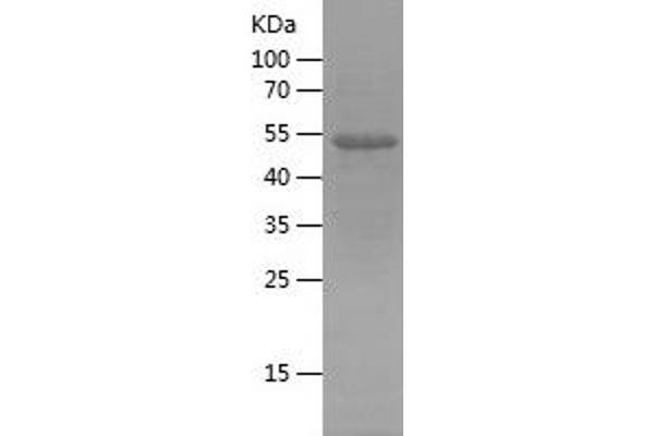 Reticulon 3 Protein (RTN3) (AA 128-358) (His-IF2DI Tag)