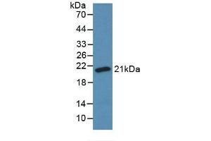 Detection of Recombinant SOD1, Bovine using Monoclonal Antibody to Superoxide Dismutase 1 (SOD1) (SOD1 抗体  (AA 2-152))