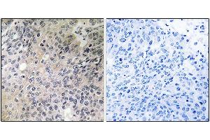 Immunohistochemistry analysis of paraffin-embedded human lung tissue using SHC3 antibody. (SHC3 抗体)