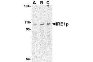 Western Blotting (WB) image for anti-Endoplasmic Reticulum To Nucleus Signaling 1 (ERN1) (C-Term) antibody (ABIN2475138)