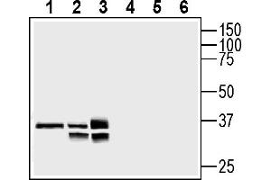 anti-Solute Carrier Family 25 (Mitochondrial Carrier), Member 18 (SLC25A18) (AA 95-110), (Intracellular) antibody