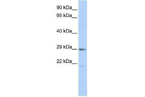 MORF4 antibody used at 0. (MORF4 抗体  (Middle Region))