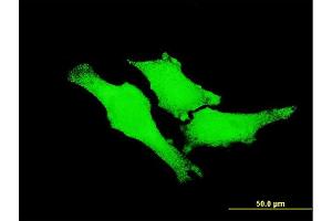 Immunofluorescence (IF) image for anti-Receptor tyrosine-protein kinase erbB-2 (ErbB2/Her2) (AA 22-121) antibody (ABIN515369)