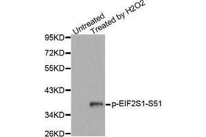 Western blot analysis of extracts from Jurkat cells, using Phospho-EIF2S1-S51 antibody.