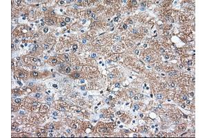 Immunohistochemical staining of paraffin-embedded Human liver tissue using anti-TBXAS1 mouse monoclonal antibody. (TBXAS1 抗体)