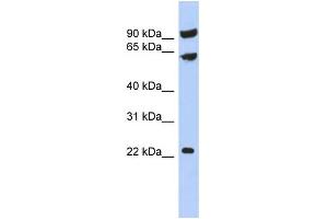WB Suggested Anti-TIGD3 Antibody Titration:  0. (TIGD3 抗体  (Middle Region))