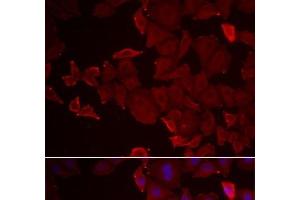 Immunofluorescence analysis of U2OS cells using MARCKSL1 Polyclonal Antibody (MARCKSL1 抗体)