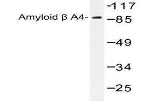 Image no. 1 for anti-Amyloid beta (A4) Precursor Protein (APP) antibody (ABIN265307) (APP 抗体)