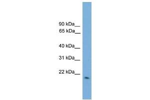 WB Suggested Anti-GPX2  Antibody Titration: 0. (Glutathione Peroxidase 2 抗体  (Middle Region))