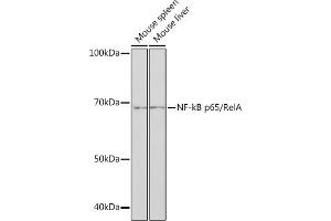 Western blot analysis of extracts of various cell lines, using NF-kB p65/RelA antibody (ABIN7268995) at 1:1000 dilution. (NF-kB p65 抗体)