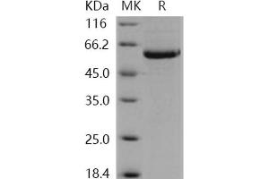 STK4 Protein (His tag)