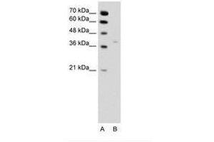 Image no. 2 for anti-Hydroxysteroid (17-Beta) Dehydrogenase 1 (HSD17B1) (N-Term) antibody (ABIN6736344) (HSD17B1 抗体  (N-Term))