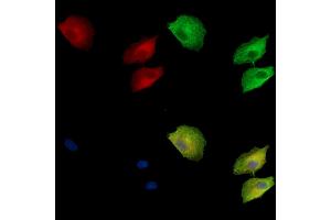 ABIN7095075 and ABIN7099131 staining  cells by IF/ICC. (CRB3 抗体)