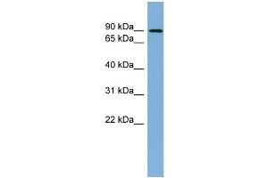 WB Suggested Anti-TBK1 Antibody Titration: 0. (TBK1 抗体  (Middle Region))