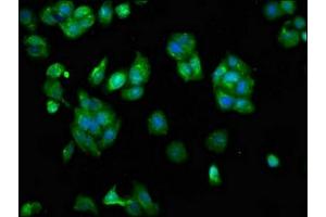 Immunofluorescence staining of HepG2 cells with ABIN7168610 at 1:133, counter-stained with DAPI. (SCARA5 抗体  (AA 303-428))