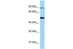 WB Suggested Anti-BMP4 Antibody Titration: 1. (BMP4 抗体  (N-Term))