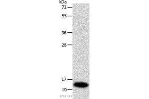 Western blot analysis of Mouse liver tissue, using SOD1 Polyclonal Antibody at dilution of 1:1160 (SOD1 抗体)