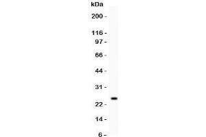 Western blot testing of Kallikrein 4 antibody and recombinant human protein (0. (Kallikrein 4 抗体  (AA 31-254))