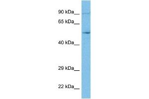 WB Suggested Anti-ACH10 antibody Titration: 1 ug/mL Sample Type: Human MCF7 Whole Cell (CHRNA10 抗体  (N-Term))
