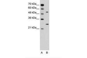 Image no. 2 for anti-Calcium Channel, Voltage-Dependent, beta 1 Subunit (CACNB1) (AA 201-250) antibody (ABIN6736600) (CACNB1 抗体  (AA 201-250))