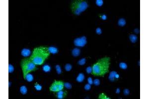 Anti-ARFGAP1 mouse monoclonal antibody (ABIN2454434) immunofluorescent staining of COS7 cells transiently transfected by pCMV6-ENTRY ARFGAP1 (RC206987). (ARFGAP1 抗体)