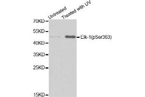 Western Blotting (WB) image for anti-ELK1, Member of ETS Oncogene Family (ELK1) (pSer383) antibody (ABIN1870156) (ELK1 抗体  (pSer383))