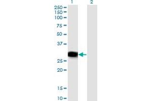 Western Blot analysis of RBPMS expression in transfected 293T cell line by RBPMS monoclonal antibody (M03), clone 1C12. (RBPMS 抗体  (AA 1-219))