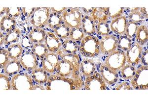 Detection of PKBa in Human Kidney Tissue using Polyclonal Antibody to Protein Kinase B Alpha (PKBa) (AKT1 抗体  (AA 122-443))