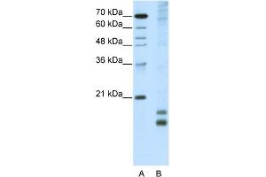 WB Suggested Anti-MAFF Antibody Titration:  5. (MafF 抗体  (N-Term))