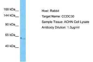 Host: Rabbit Target Name: CCDC30 Sample Tissue: Human ACHN Whole Cell  Antibody Dilution: 1ug/ml (CCDC30 抗体  (C-Term))