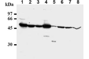 Western Blotting (WB) image for anti-Checkpoint Kinase 1 (CHEK1) antibody (ABIN487487) (CHEK1 抗体)