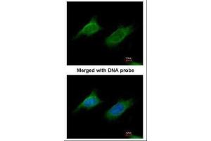ICC/IF Image Immunofluorescence analysis of paraformaldehyde-fixed HeLa, using NAGLU, antibody at 1:200 dilution. (NAGLU 抗体  (Center))
