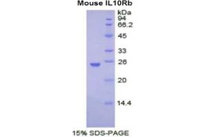 SDS-PAGE analysis of Mouse IL10Rb Protein. (IL10RB 蛋白)