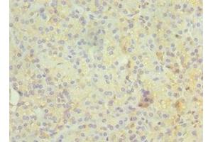 Immunohistochemistry of paraffin-embedded human pancreatic tissue using ABIN7167347 at dilution of 1:100 (Rab4 抗体  (AA 1-218))