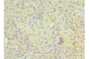 Immunohistochemistry of paraffin-embedded human pancreatic tissue using ABIN7167347 at dilution of 1:100 (Rab4 抗体  (AA 1-218))