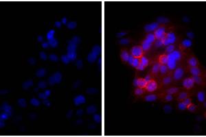 Human epithelial carcinoma cell line HEp-2 was stained with Mouse Anti-Human CD44-UNLB and DAPI. (山羊 anti-小鼠 IgG (Heavy & Light Chain) Antibody (Texas Red (TR)))