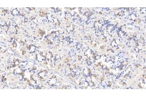Detection of MYH9 in Human Stomach Tissue using Polyclonal Antibody to Myosin Heavy Chain 9, Non Muscle (MYH9) (Myosin 9 抗体  (AA 1740-1960))
