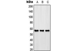 Western blot analysis of GPR176 expression in HeLa (A), SP2/0 (B), rat liver (C) whole cell lysates. (GPR176 抗体  (C-Term))