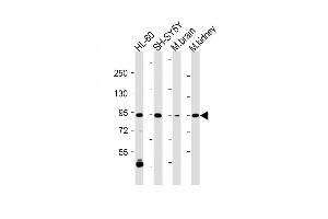 All lanes : Anti-ZPK Antibody (C-term) at 1:2000 dilution Lane 1: HL-60 whole cell lysate Lane 2: SH-SY5Y whole cell lysate Lane 3: Mouse brain lysate Lane 4: Mouse kidney lysate Lysates/proteins at 20 μg per lane. (MAP3K12 抗体  (C-Term))