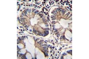 Immunohistochemistry analysis in formalin fixed and paraffin embedded human rectum tissue reacted with NAD-ME Antibody (C-term) followed which was peroxidase conjugated to the secondary antibody and followed by DAB staining. (NAD-ME 抗体  (C-Term))