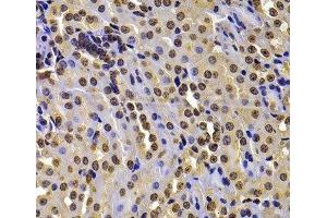 Immunohistochemistry of paraffin-embedded Mouse kidney using WHSC1 Polyclonal Antibody at dilution of 1:100 (40x lens). (WHSC1 抗体)