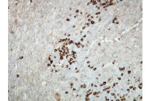 Immunohistochemistry (IHC) image for anti-kappa Light Chain (AA 47-63), (N-Term) antibody (ABIN870362) (kappa Light Chain 抗体  (N-Term))