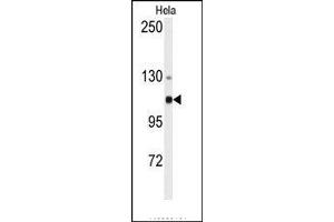 Image no. 1 for anti-Actinin, alpha 4 (ACTN4) (N-Term) antibody (ABIN360099) (alpha Actinin 4 抗体  (N-Term))