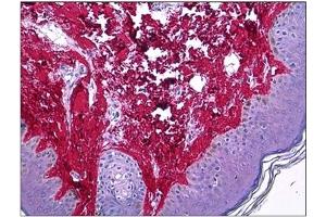 Immunohistochemistry (IHC) image for anti-Collagen, Type I (COL1) antibody (ABIN782308) (Collagen Type I 抗体)