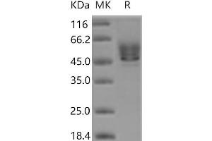 Western Blotting (WB) image for Syndecan 1 (SDC1) protein (His tag) (ABIN7321114) (Syndecan 1 Protein (SDC1) (His tag))