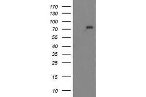 Western Blotting (WB) image for anti-Myotubularin Related Protein 2 (MTMR2) antibody (ABIN1499591) (MTMR2 抗体)