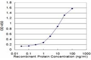 Image no. 1 for anti-S100 Calcium Binding Protein A8 (S100A8) (AA 1-94) antibody (ABIN961221) (S100A8 抗体  (AA 1-94))