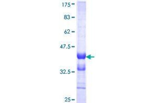 ESM1 Protein (AA 85-184) (GST tag)