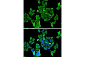Immunofluorescence (IF) image for anti-Cell Division Cycle and Apoptosis Regulator 1 (CCAR1) antibody (ABIN1980350) (CCAR1 抗体)